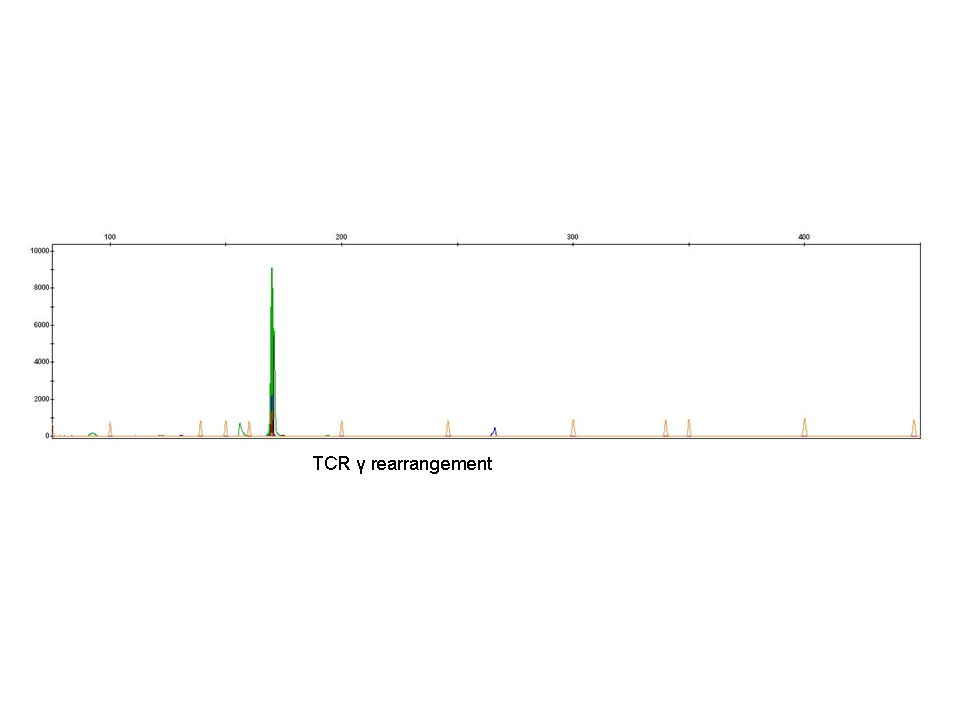 TCR rearrangement